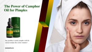 Camphor Oil for Pimples