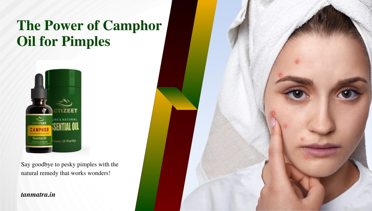 Camphor Oil for Pimples